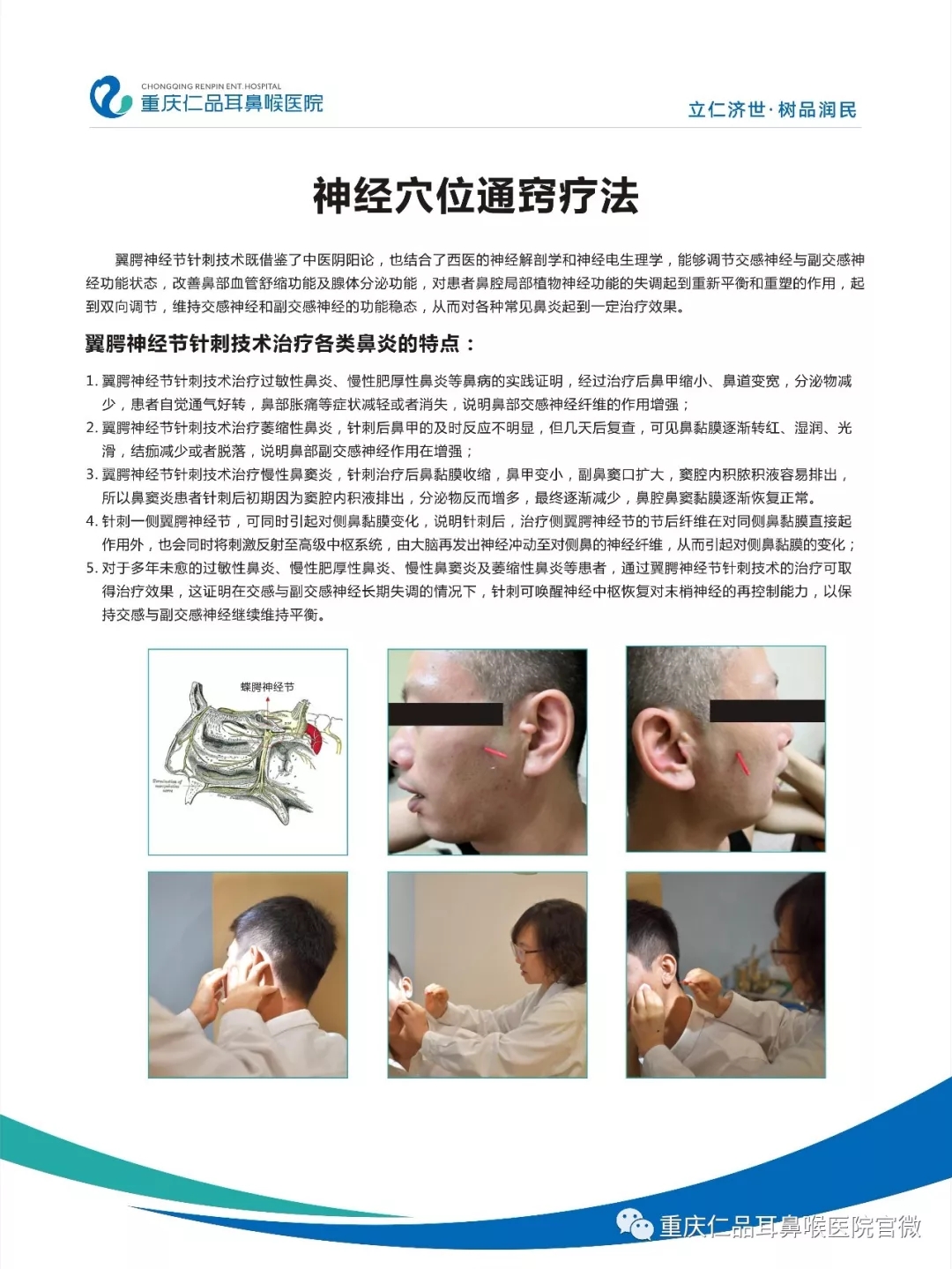 变应性(过敏性)鼻炎诊断和治疗指南与最新治疗方式