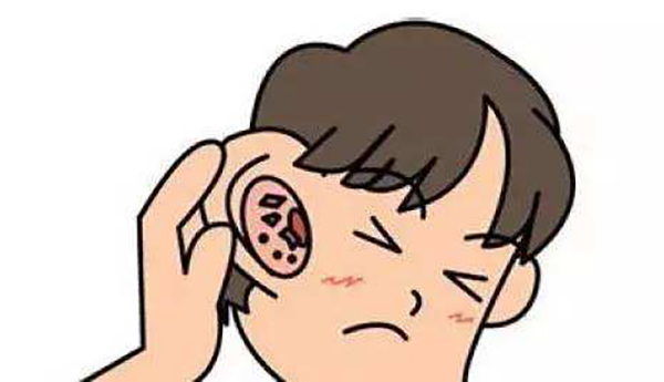 治疗耳鸣中医好还是西医好