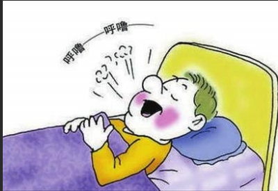 鼾症