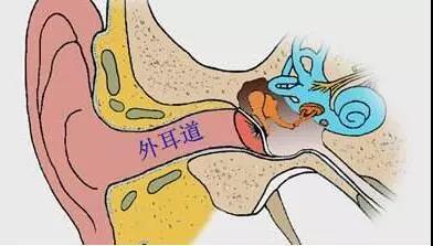 外耳道炎