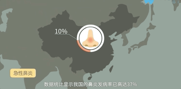 过敏性鼻炎