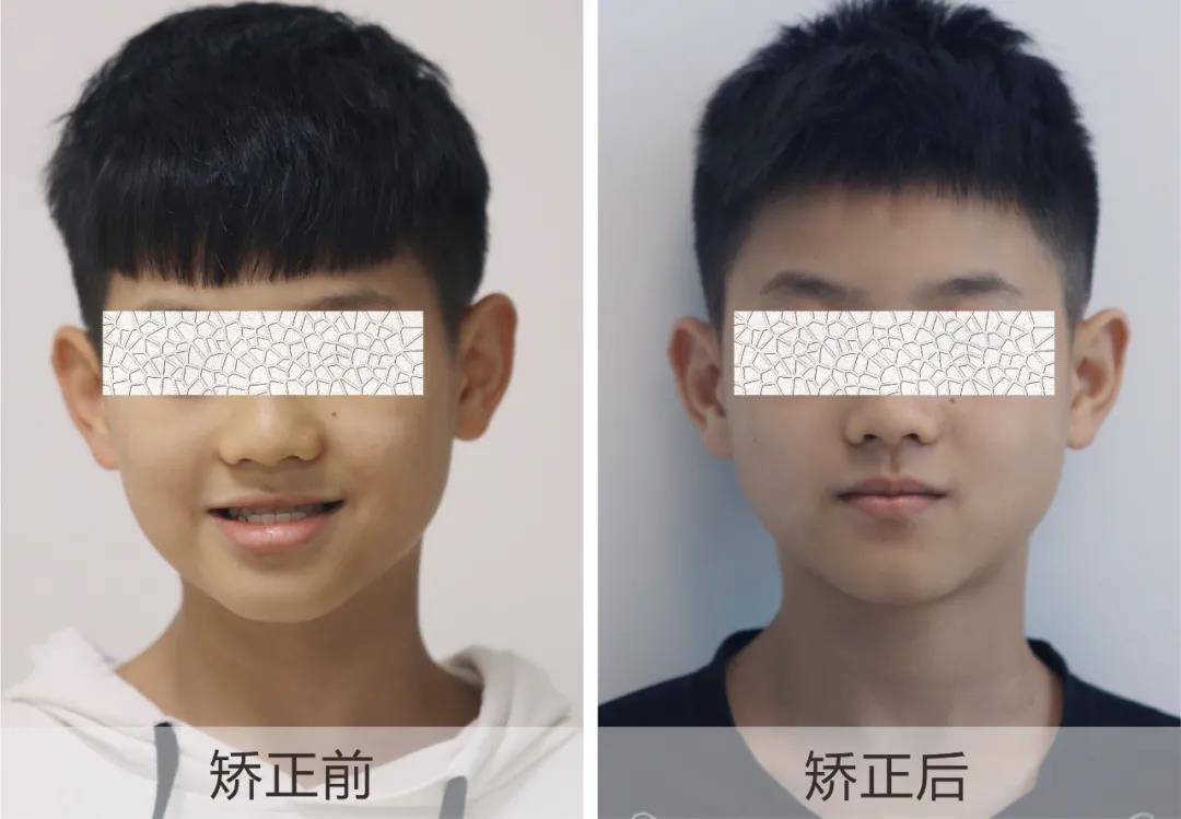 重庆耳鼻喉医院