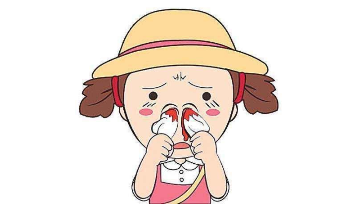 儿童鼻出血