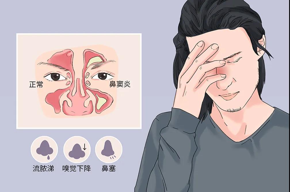 鼻窦炎的危害