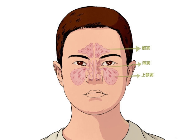 儿童鼻窦炎的治疗