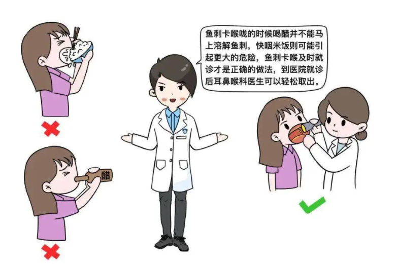 重庆治疗卡鱼刺医院