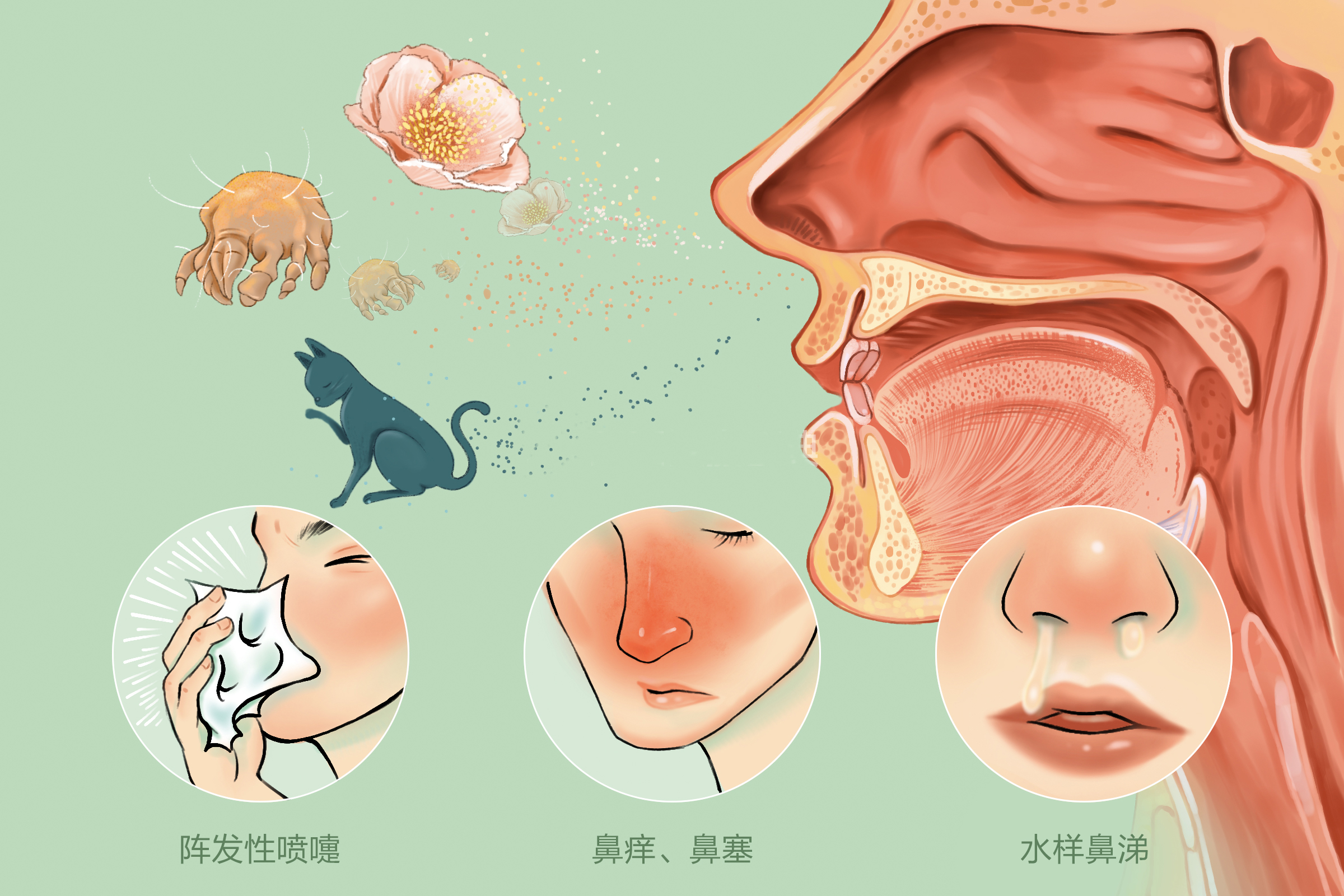 重庆治疗过敏性鼻炎医院